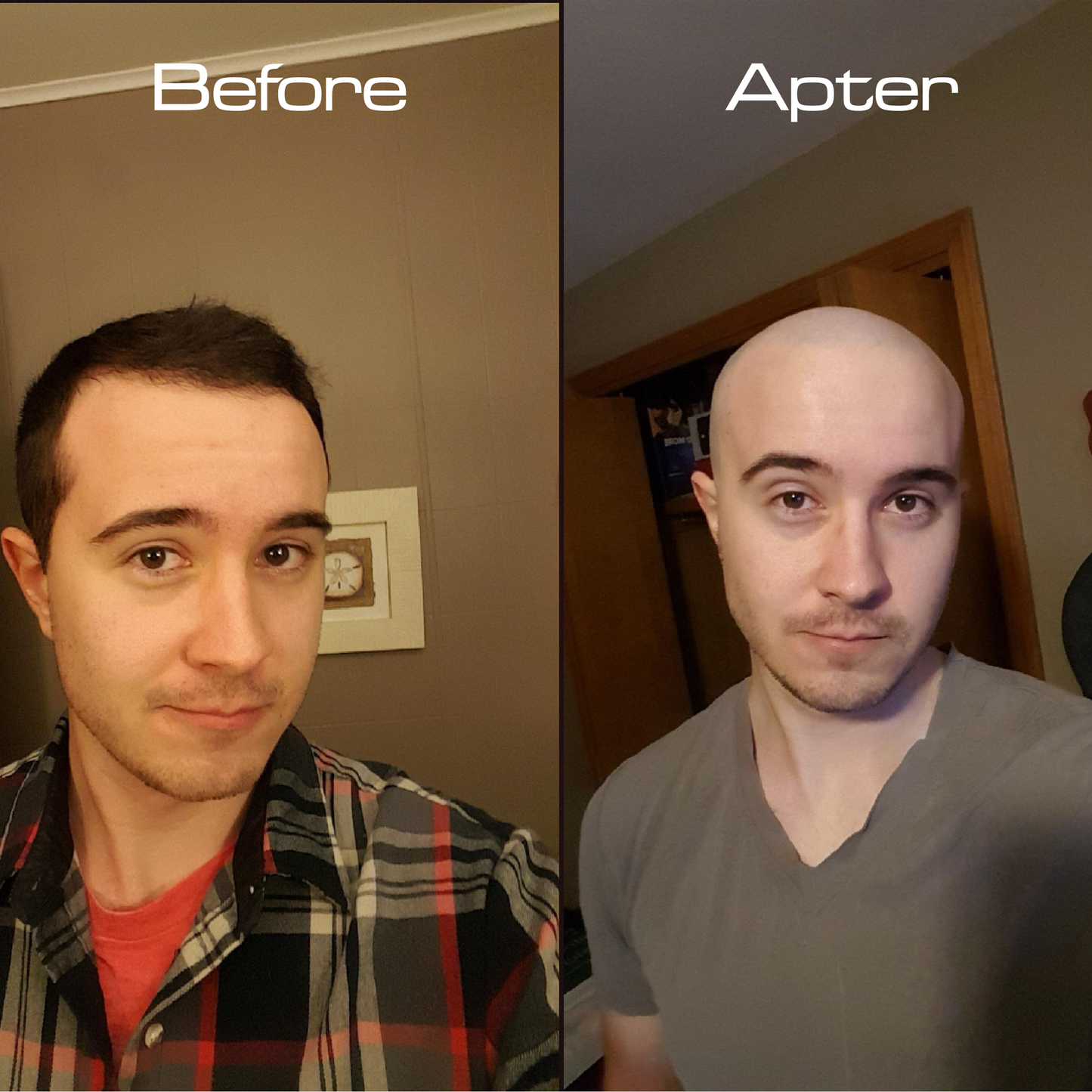 Backly CleanDome™: Turn Baldness Into Boldness In Just 5 Minutes