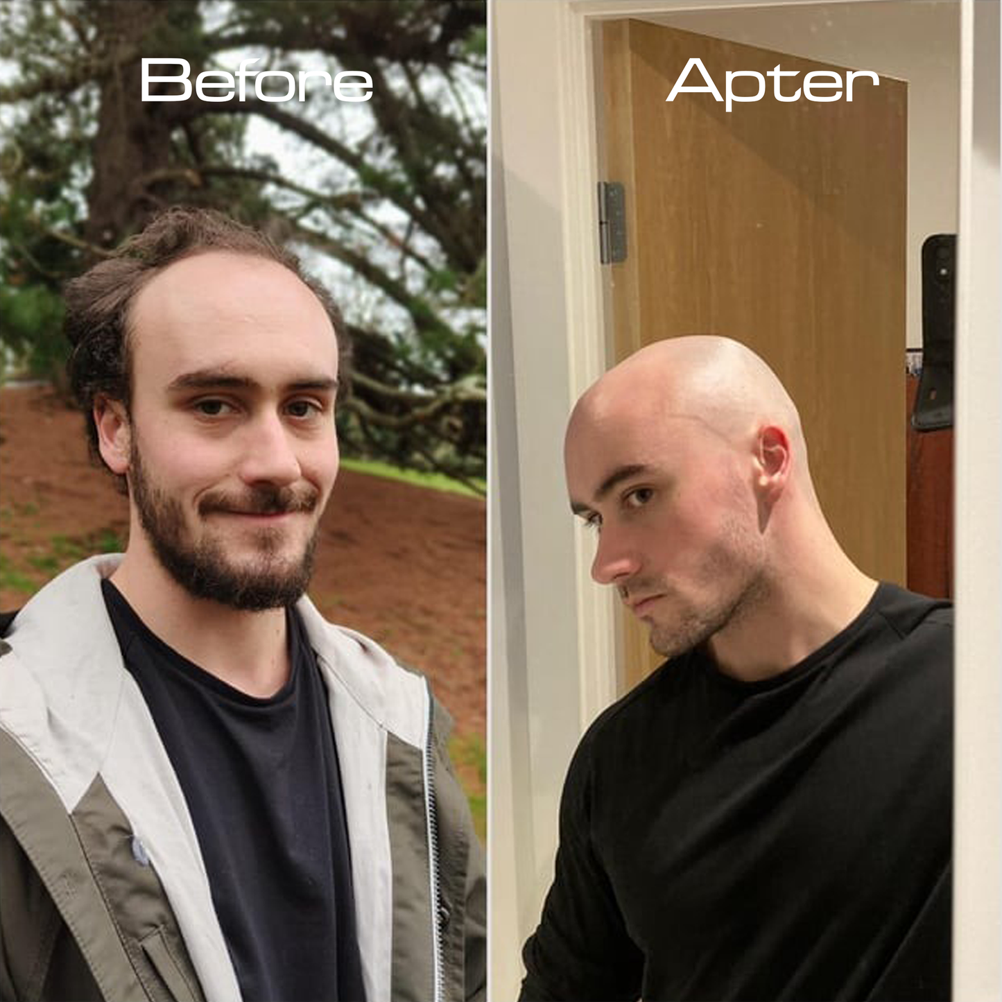 Backly CleanDome™: Turn Baldness Into Boldness In Just 5 Minutes